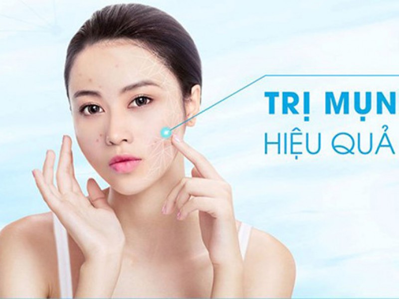 Trị mụn hiệu quả bằng dầu mu u chỉ sau 2 tuần 